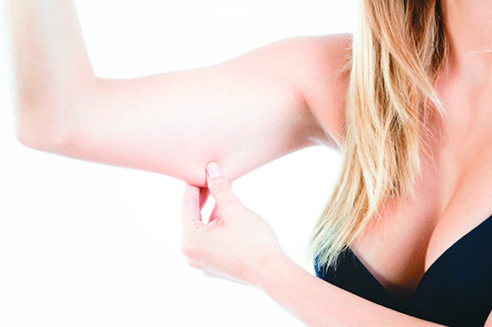 Braquioplastia