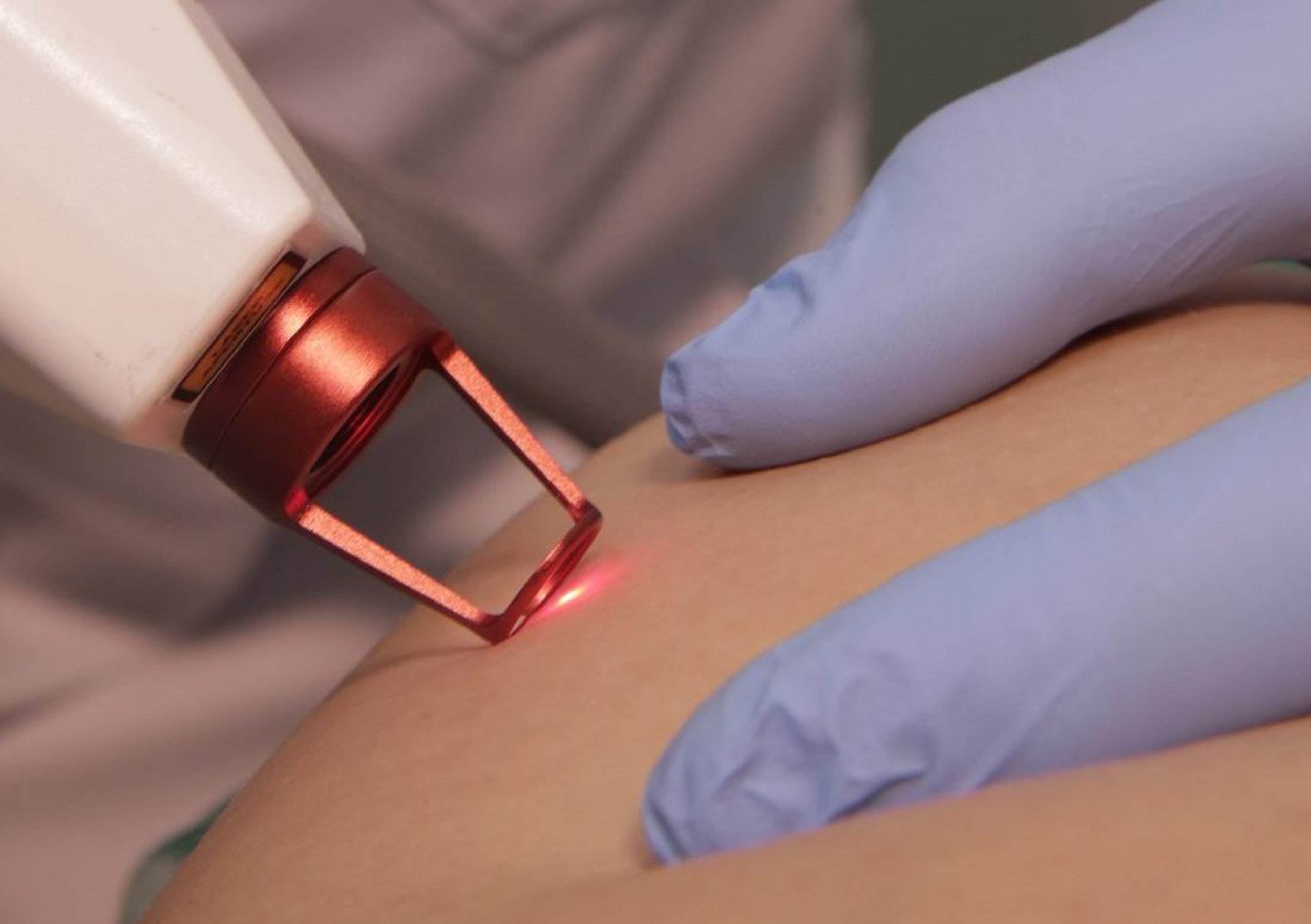 Laser Vascular